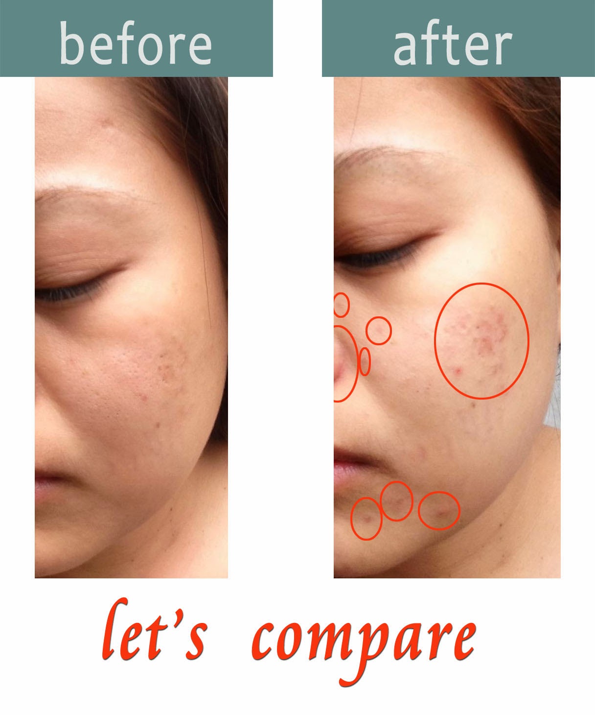 Get Skin lightening 7 days Self Help For Skin